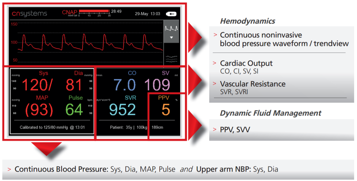 CNAP Monitor - Full Hemodynamic